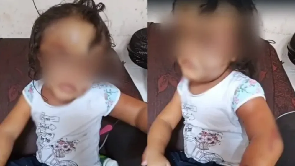 Mãe presa por agredir filha de 3 anos com cabo de vassoura é solta após pagar fiança de R$ 1 mil em MT