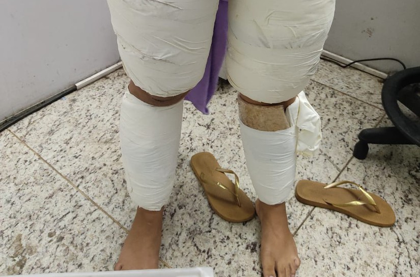 Polícia Federal Prende Duas Passageiras com Mais de 10 Quilos de Cocaína no Aeroporto Marechal Rondon